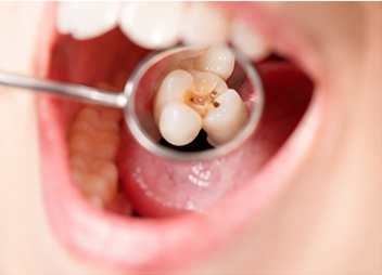 Odontología Restauradora